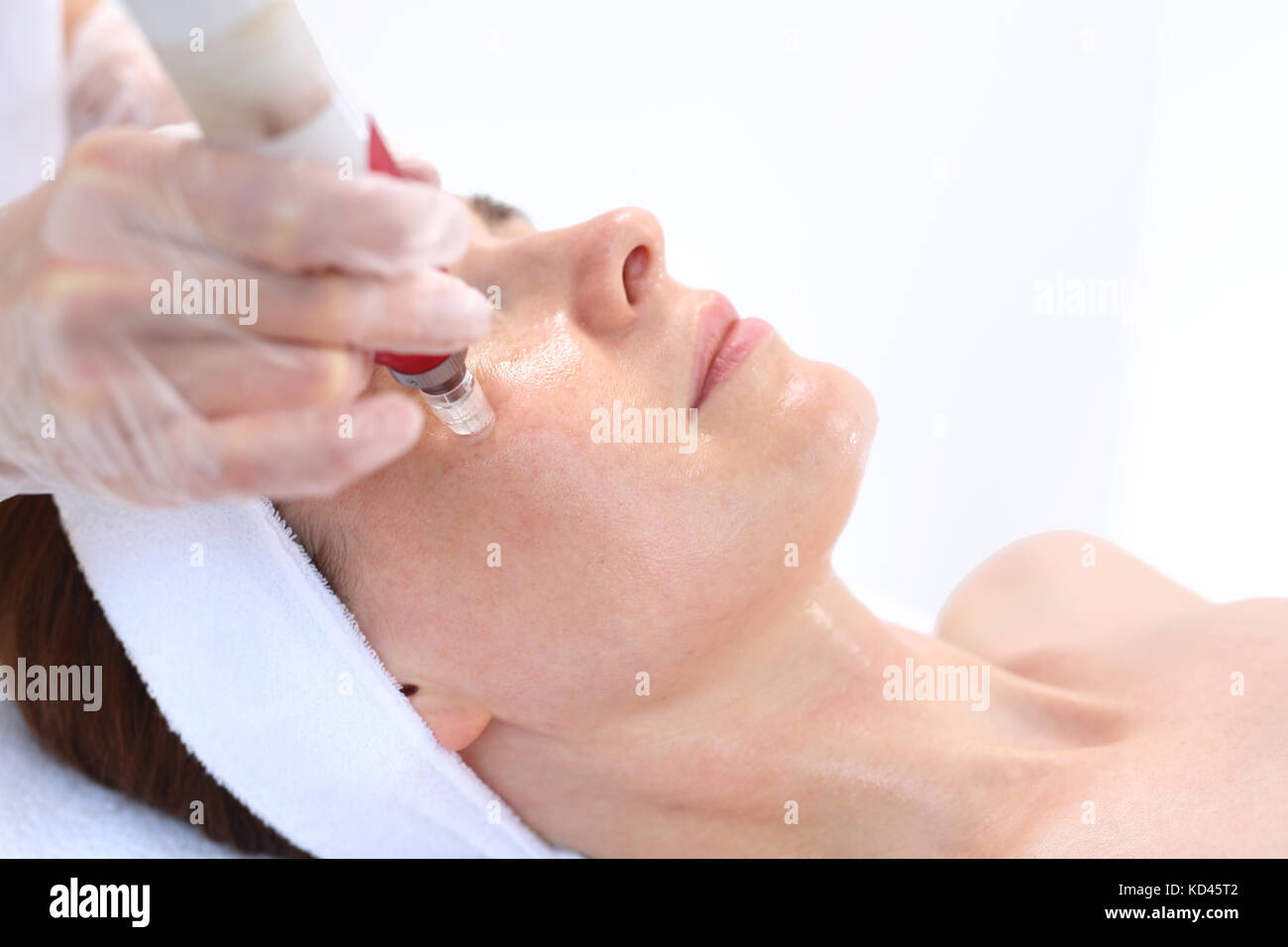 La mésothérapie microaiguille, la femme à l'esthéticienne esthéticienne. effectue un traitement mésothérapie aiguille sur le visage d'une femme Banque D'Images