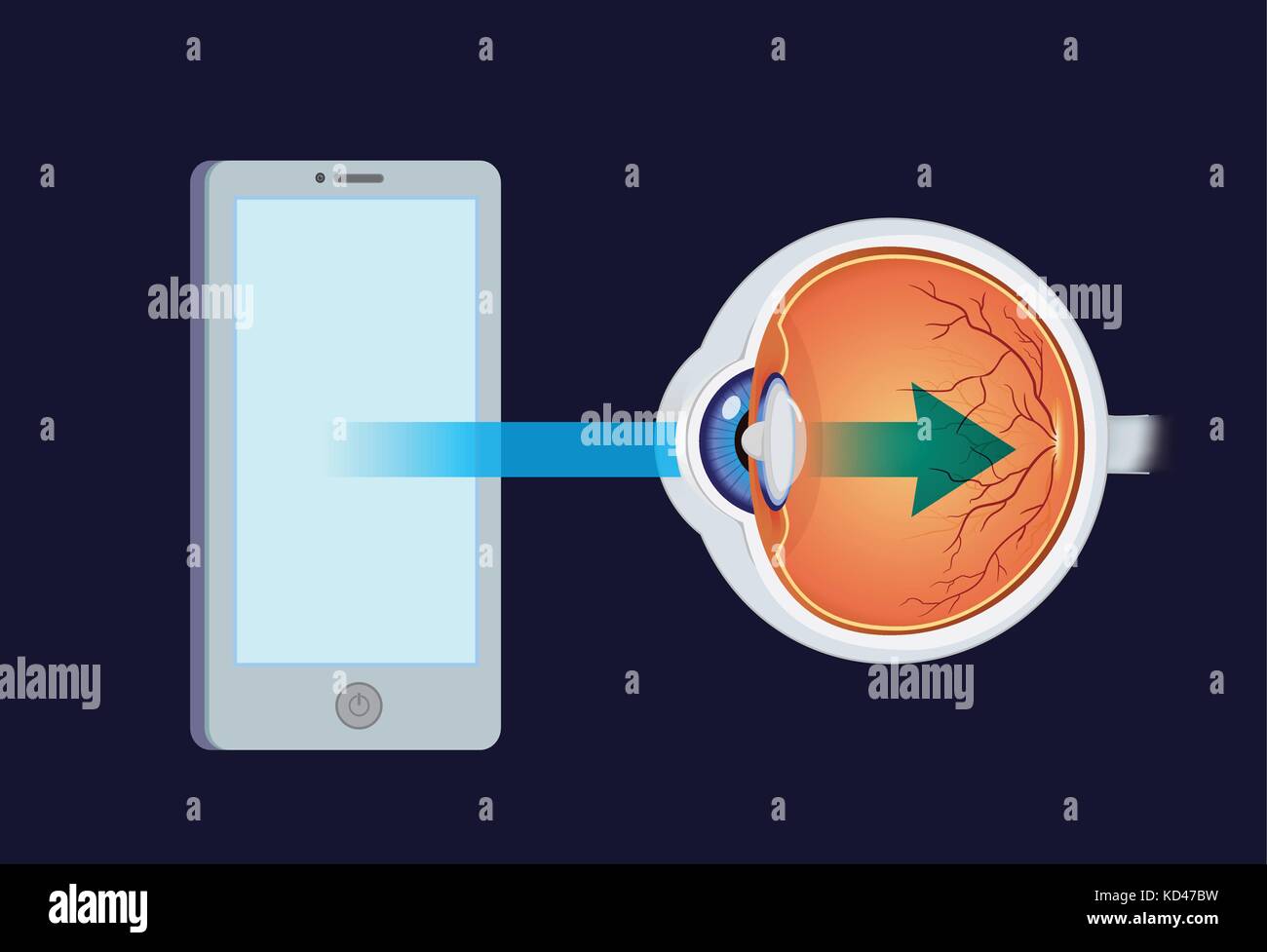La lumière bleue du smartphone dans l'œil. Illustration de Vecteur