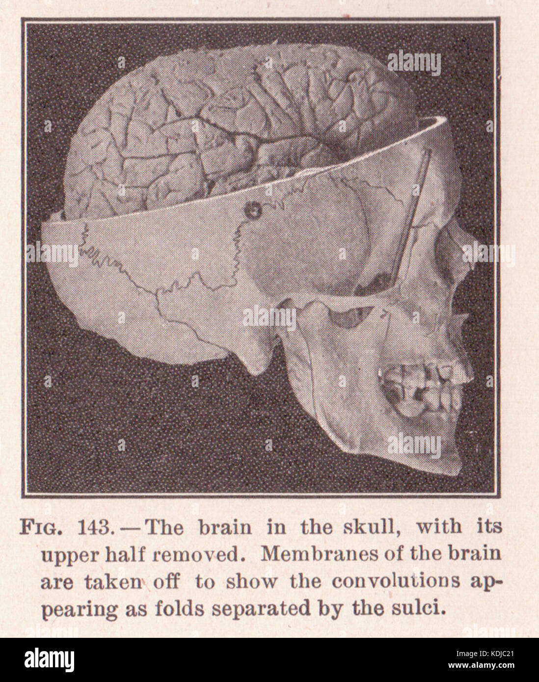 Page 215 le crâne et cerveau Banque D'Images