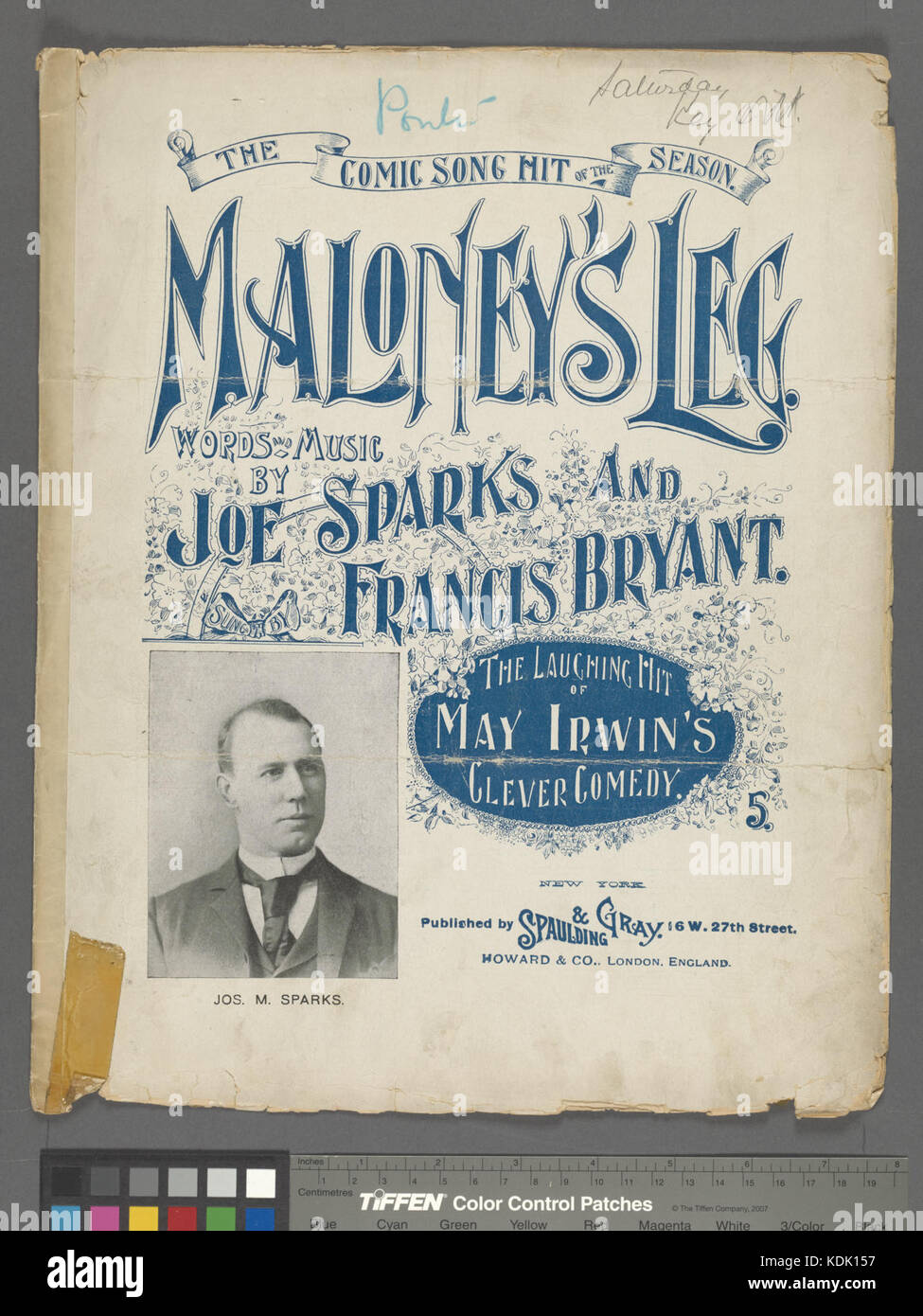 Une image intitulée 'Maloney's Leg', se référant peut-être à une étude médicale ou anatomique. Cela pourrait être une référence historique à une figure notable ou à un cas médical au début du XXe siècle. Banque D'Images