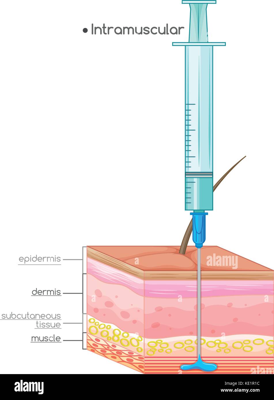 Schéma de l'injection intramusculaire illustration Illustration de Vecteur