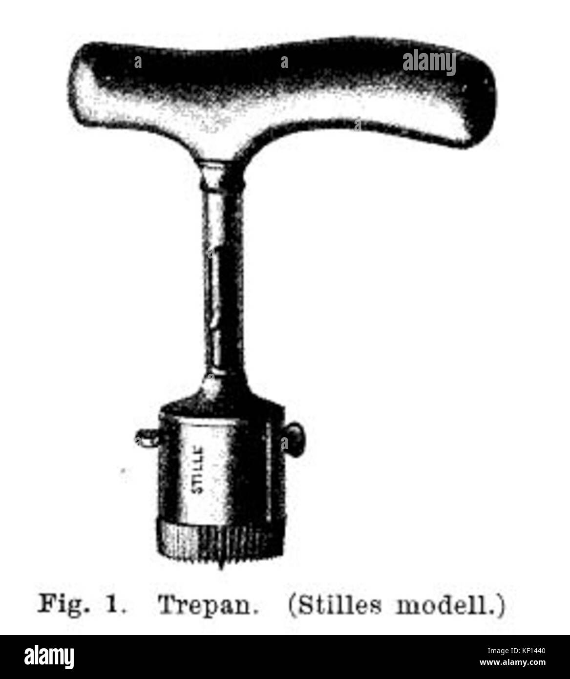 Fig 1 Trepan Banque D'Images