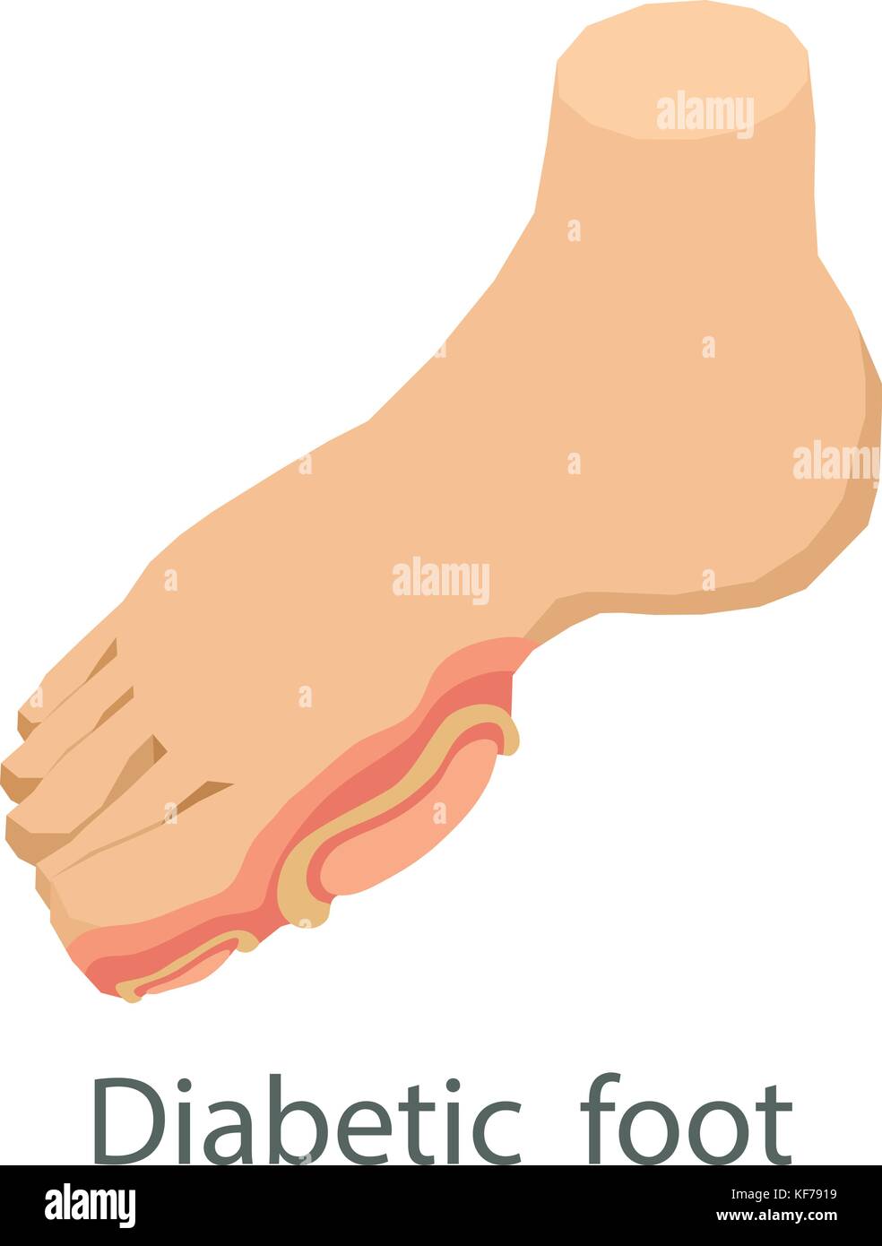 L'icône du pied diabétique, style isométrique Illustration de Vecteur