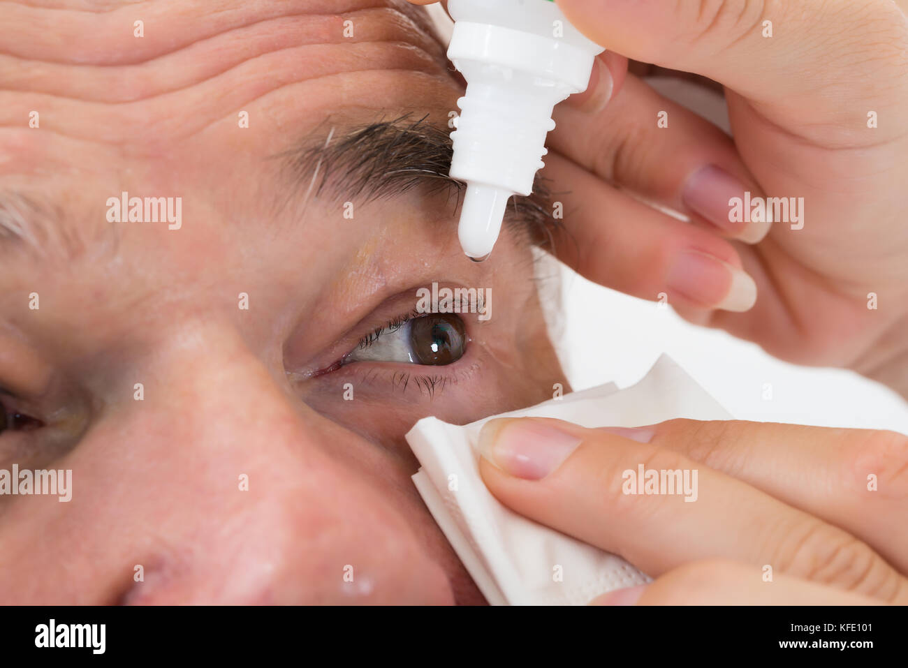 Close-up d'un optométriste's part mettre des gouttes dans les yeux du patient Banque D'Images