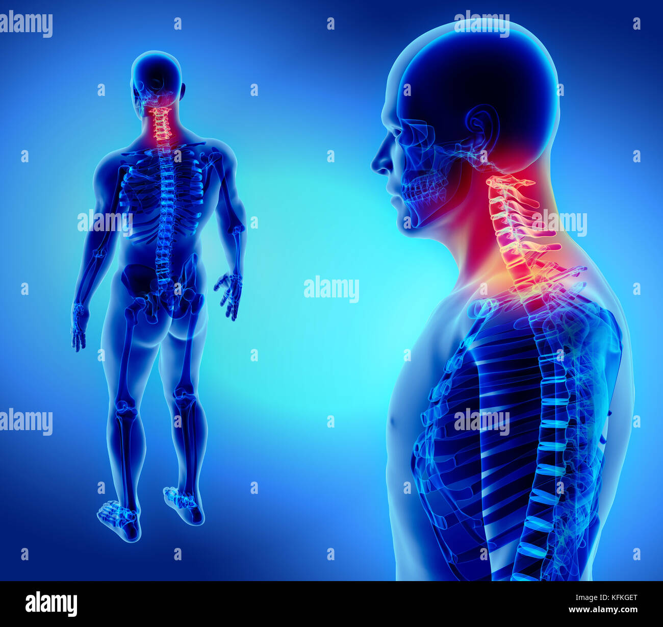 3D illustration de rachis cervical - Partie de squelette humain Photo ...