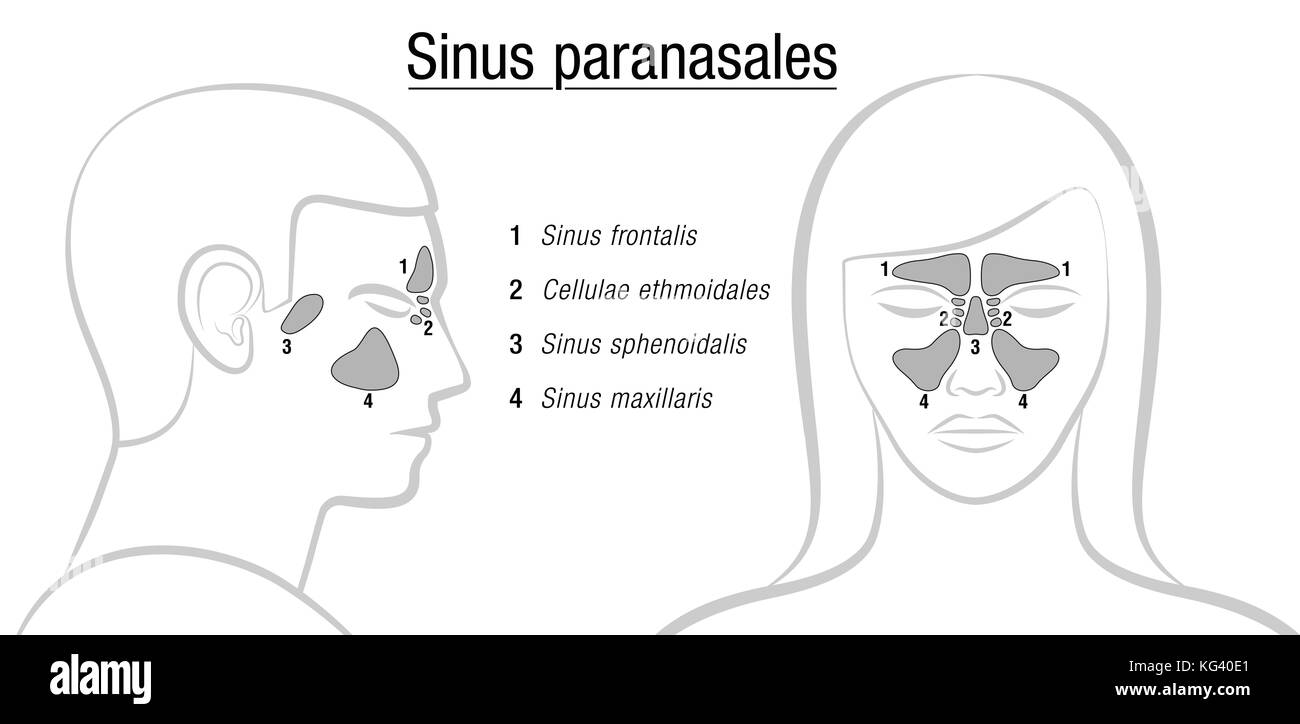 Les sinus avec les noms latins - profil mâle et femelle vue de face face. frontale, ethmoidal sphénoïdales, maxillaire et sinus. Banque D'Images