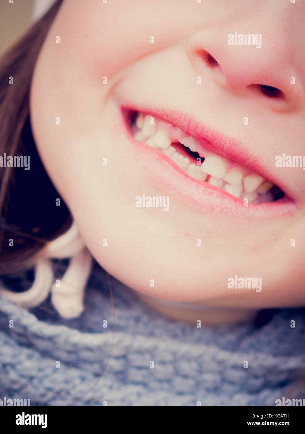 Le sourire de la jeune fille avec suceur plat et dent de lait après la percée des dents permanentes Banque D'Images