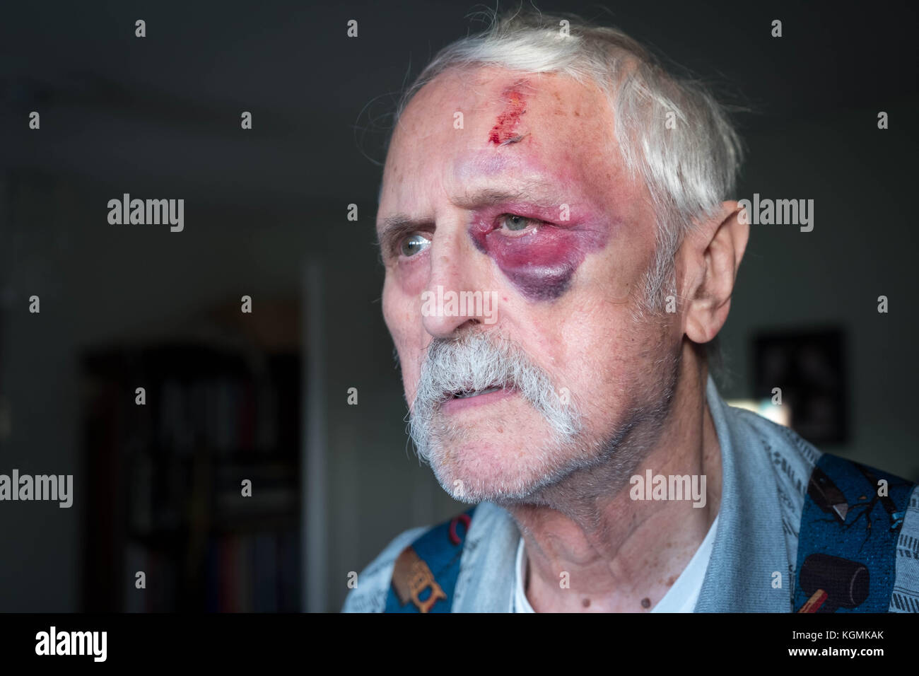 Un homme âgé avec a fortement entamé la face Banque D'Images