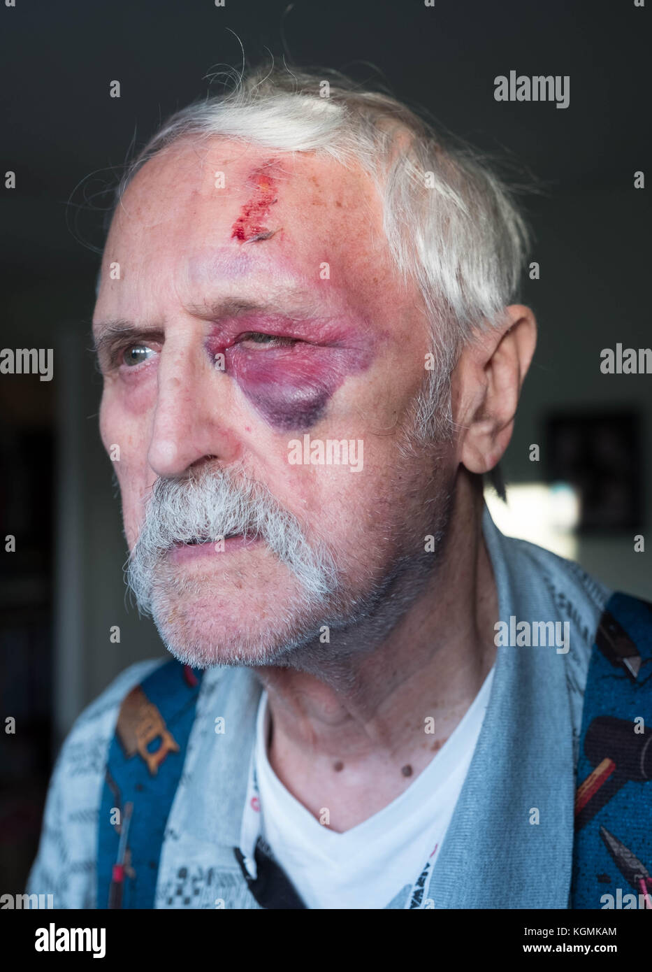 Un homme âgé avec a fortement entamé la face Banque D'Images