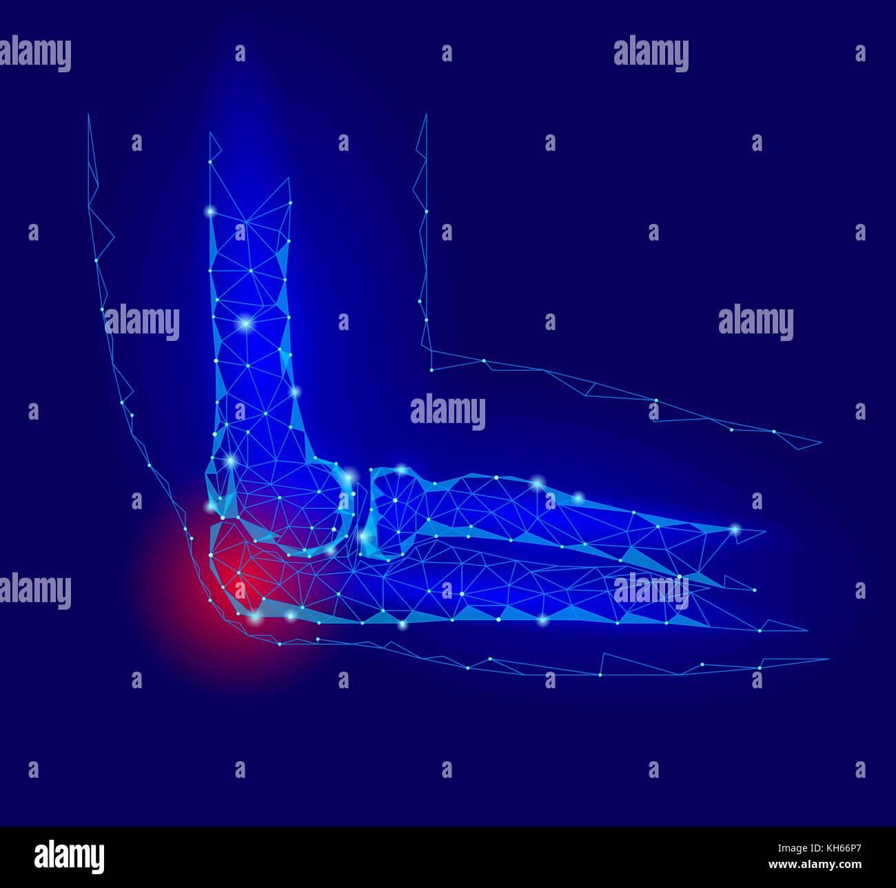 La maladie de l'articulation du coude douloureux douleur faible zone rouge. geomentic médecine poly avenir concept technologie. L'innovation medicine science. bras cubitus illustration vectorielle connexion polygonale dommage Illustration de Vecteur