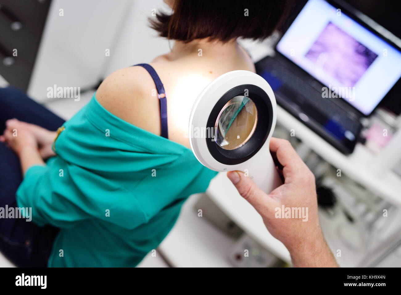 Le dermatologue examine les taupes du patient avec l'aide d'une loupe électoral spécial. Banque D'Images