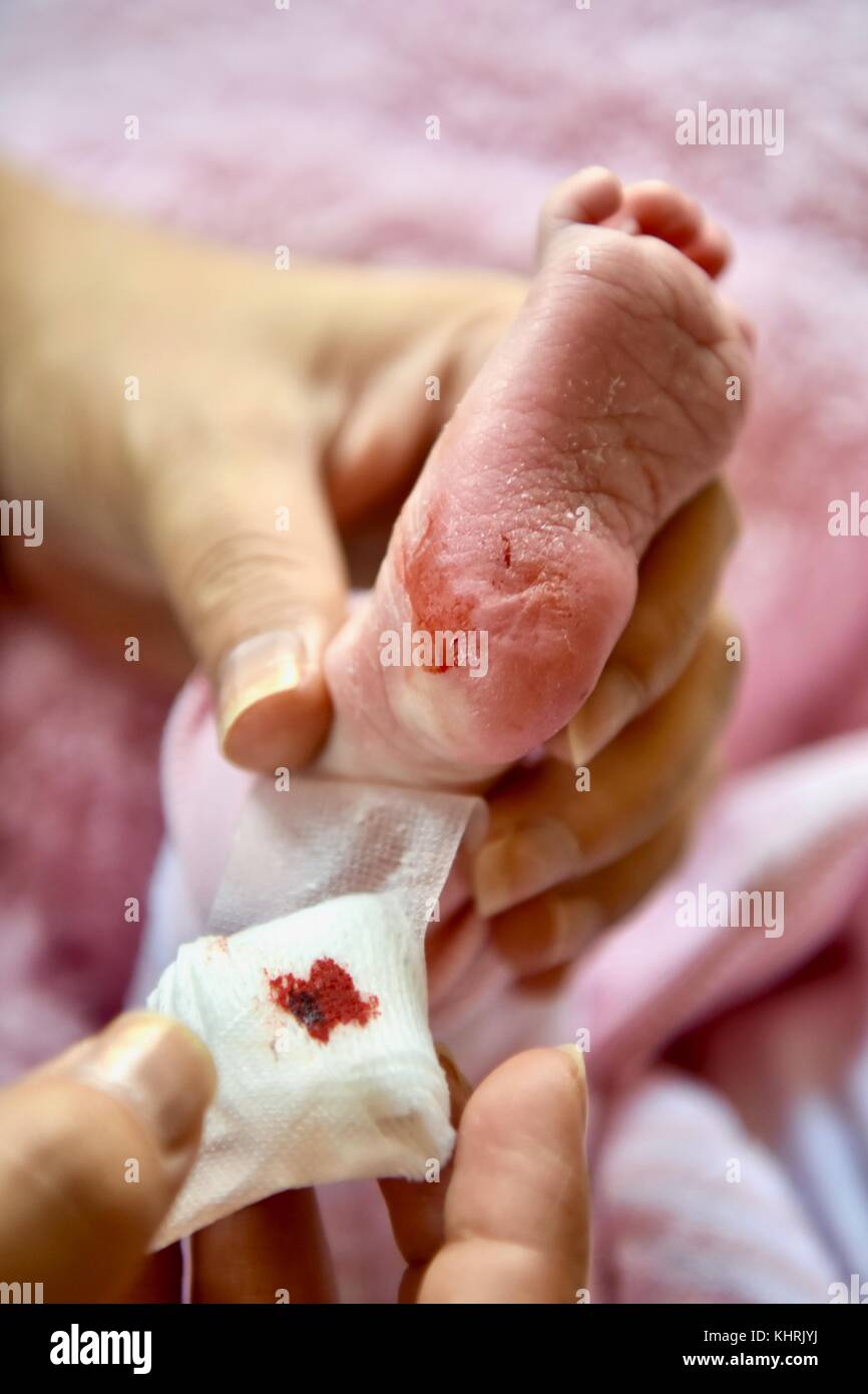 Bebe Nouveau Ne Apres Prise De Sang Pku Photo Stock Alamy