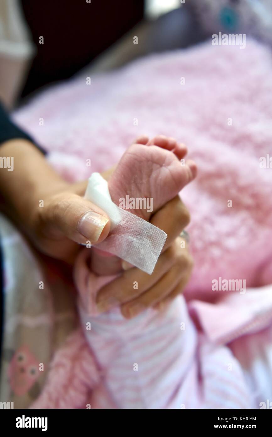 Nouveau-né pied de bébé après test sanguin PKU Banque D'Images