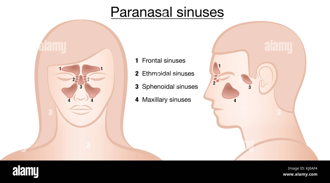 La représentation anatomique des sinus paranasaux et leurs noms - frontaux, ethmoidal sphénoïdales et sinus maxillaire, - hommes et femmes. Banque D'Images