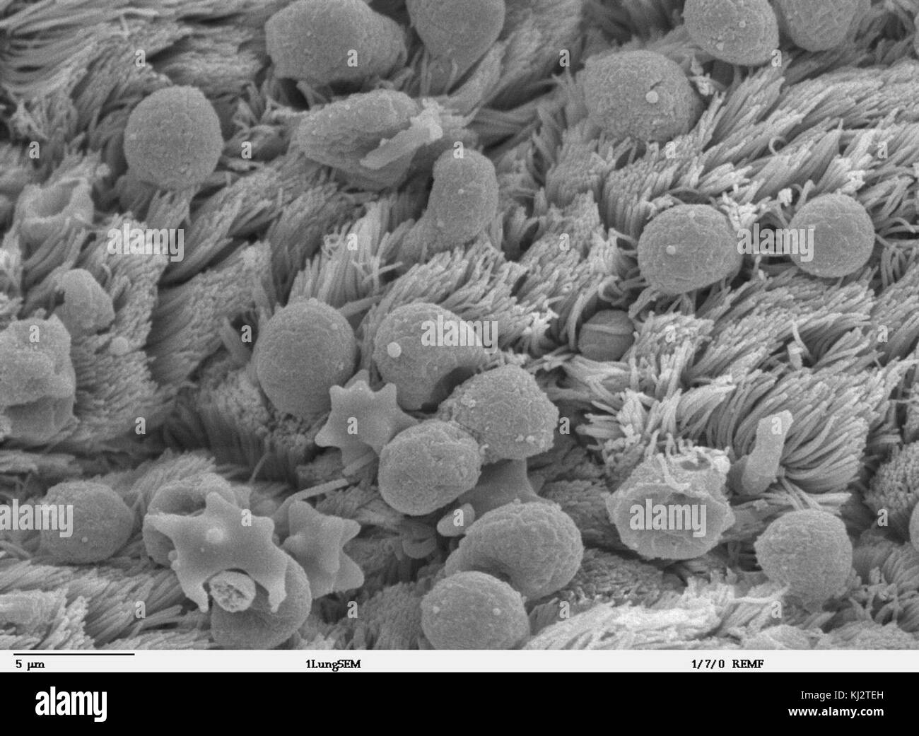 Épithélium bronchiolaire 2 - SEM Banque D'Images