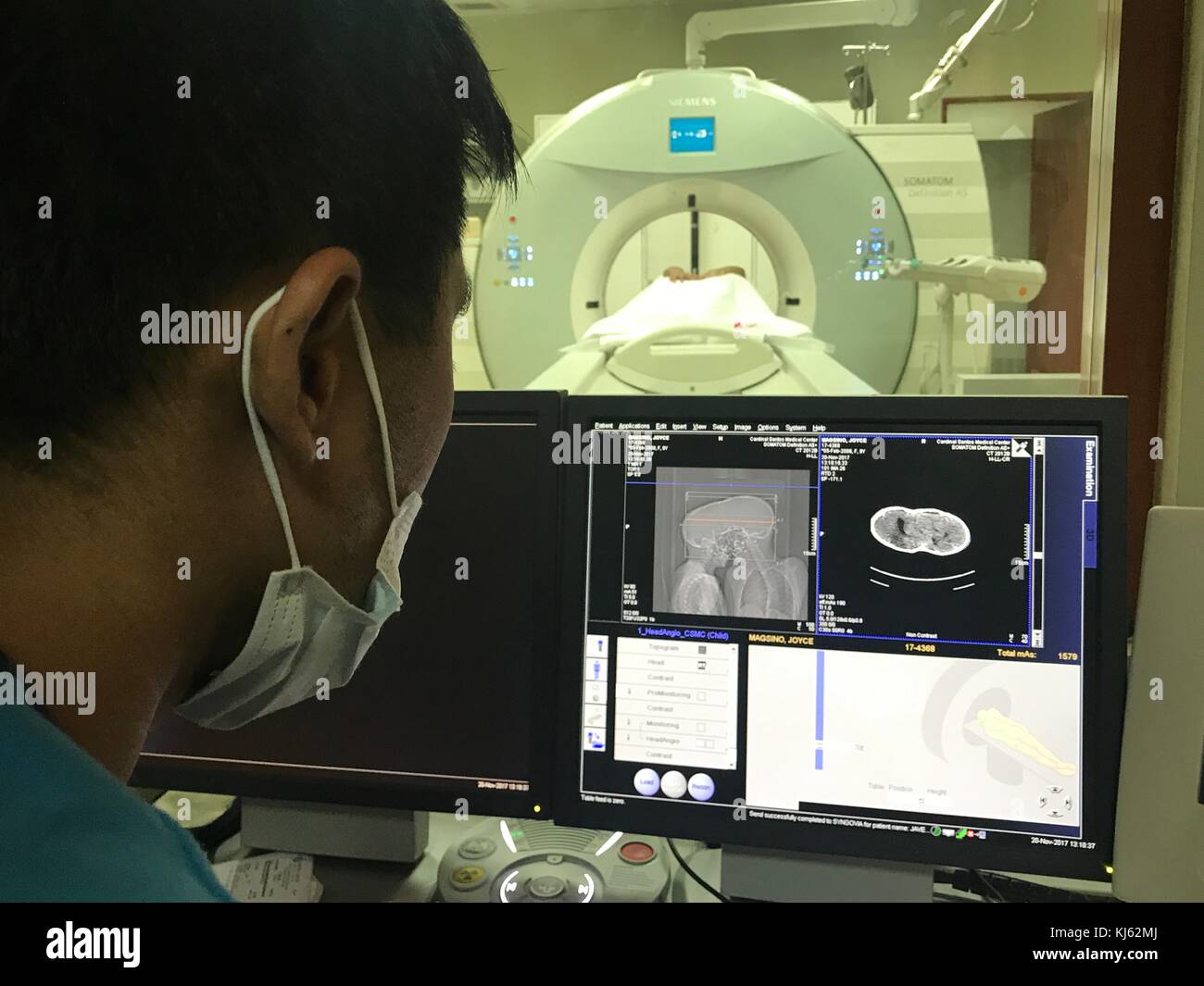 San Juan, aux Philippines. 20 nov, 2017. Joie et Joyce magsino, vieux de 10 ans sont des frères siamois en espérant que par une chirurgie qu'ils seront séparés et ont leur propre vie. Les jumeaux siamois subissant différentes procédures médicales en préparation de leur séparation. les jumeaux aimait aussi jouer à des jeux sur leur téléphone mobile. sherbien dacalanio : crédit/pacific press/Alamy live news Banque D'Images