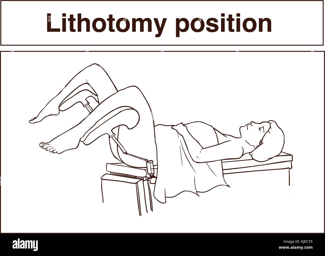 Lithotomy position Banque de photographies et d’images à haute