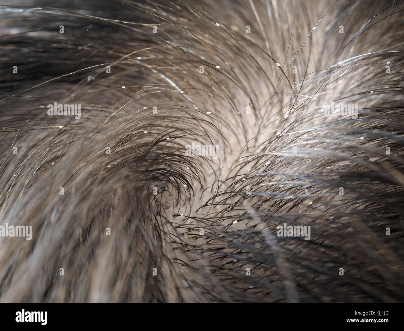 Le Regard Dans Les Cheveux Des Larves Et Les Lentes Les Poux Photo Stock Alamy Le Regard Dans Les Cheveux Des Larves Et Les Lentes Les Poux Photo Stock Alamy