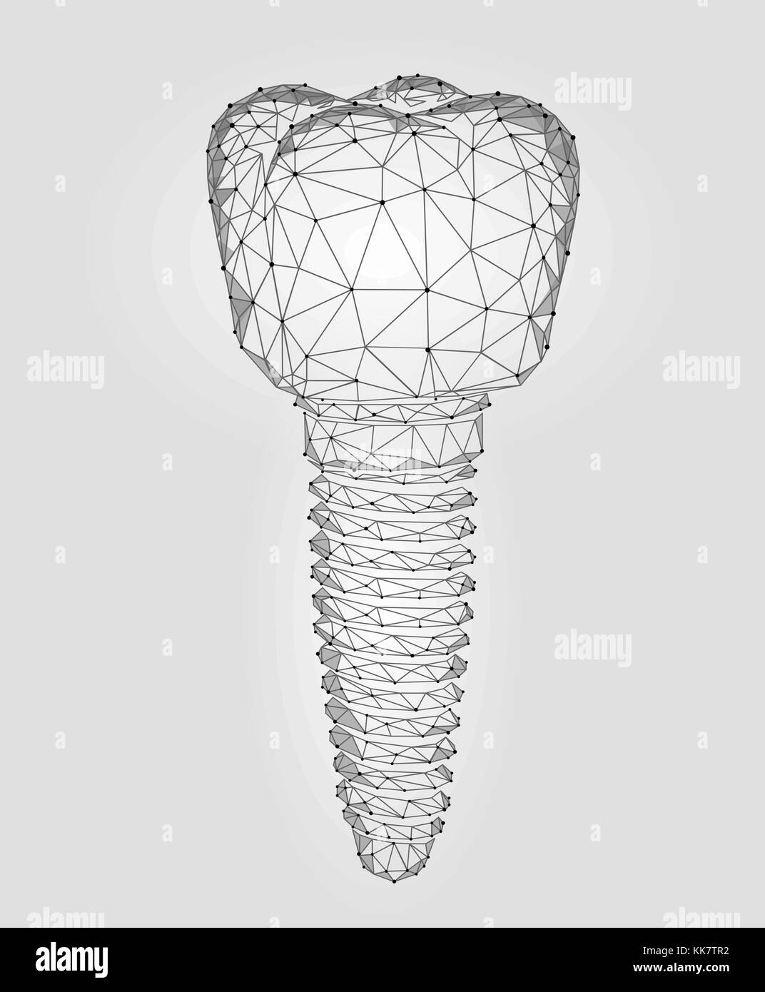 Implant dentaire dent molaire faible 3d modèle géométrique poly future technologie innovation dentaire. titan metal thread. medical science saine abstract blanc gris point d'illustration vectorielle ligne polygonale Illustration de Vecteur