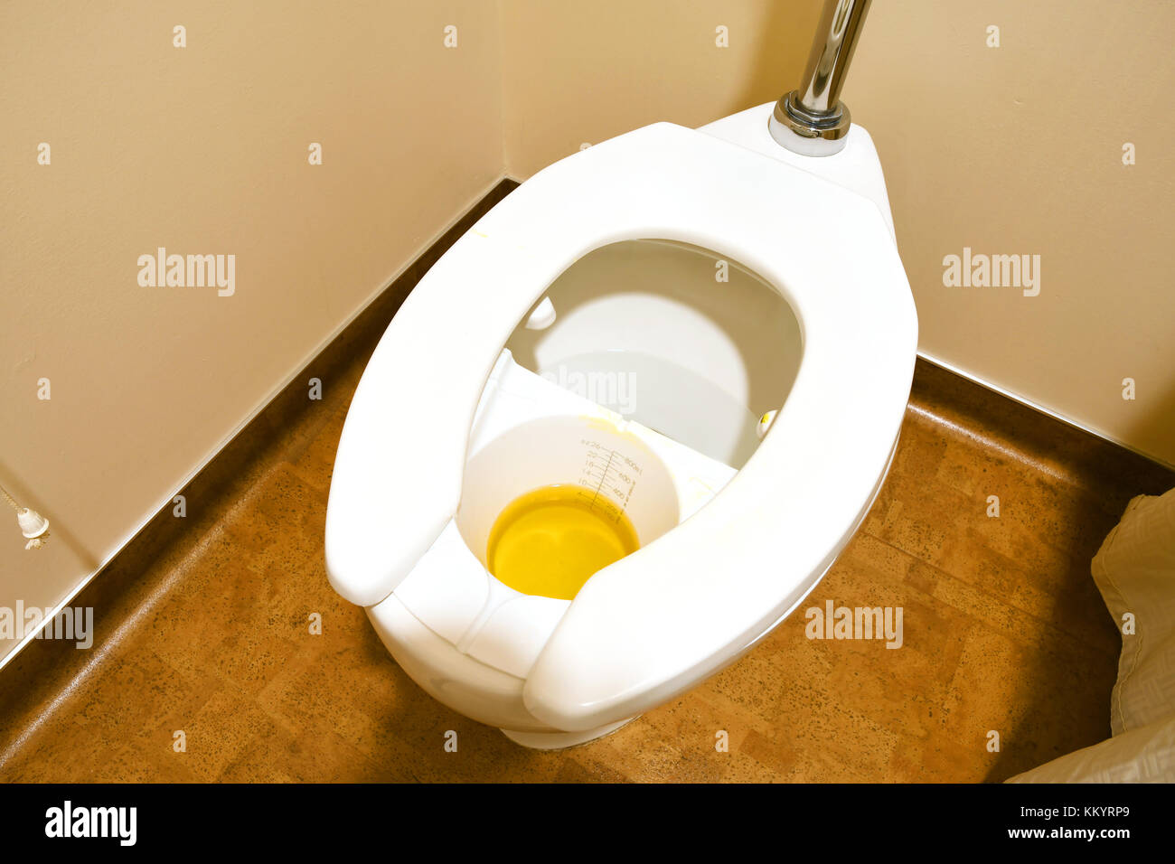 Chapeau en plastique dans un hôpital toilettes contenant un échantillon  d'urine Photo Stock - Alamy