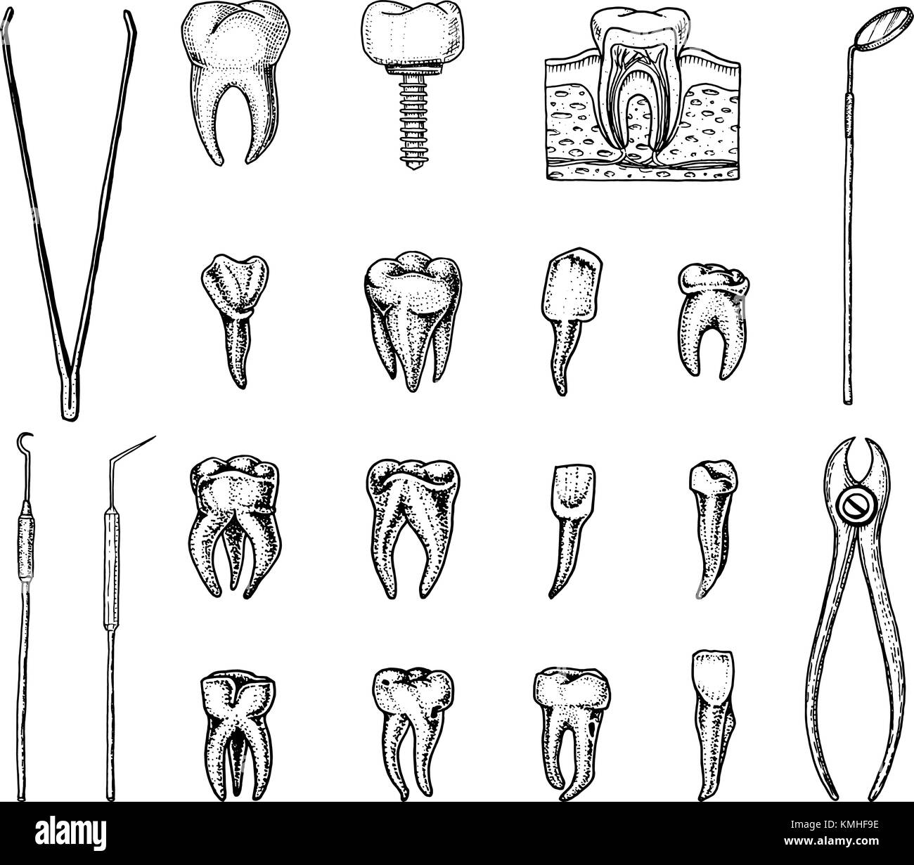 L'émail des dents molaires, ensemble de soins dentaires de l'équipement. instruments médecin dentiste. cavité orale nettoyer ou malades. la santé ou des caries. gravés à la main dans de vieux ou croquis. médecine, soins pour l'implant, l'empreinte Illustration de Vecteur