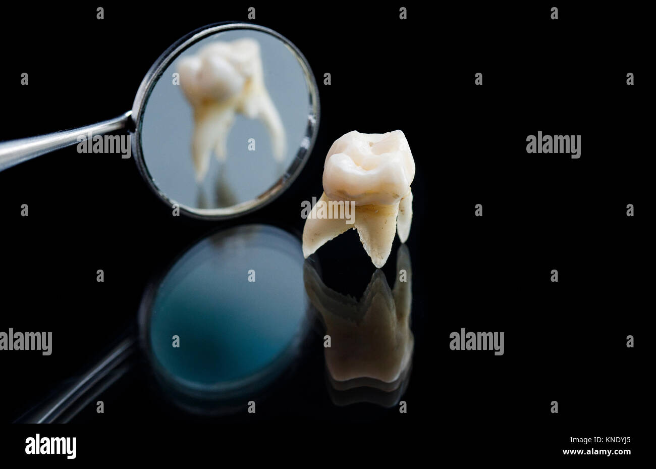 Mauvaise dent pourri retiré avec une pince métallique et se reflète dans le miroir dentaire Banque D'Images