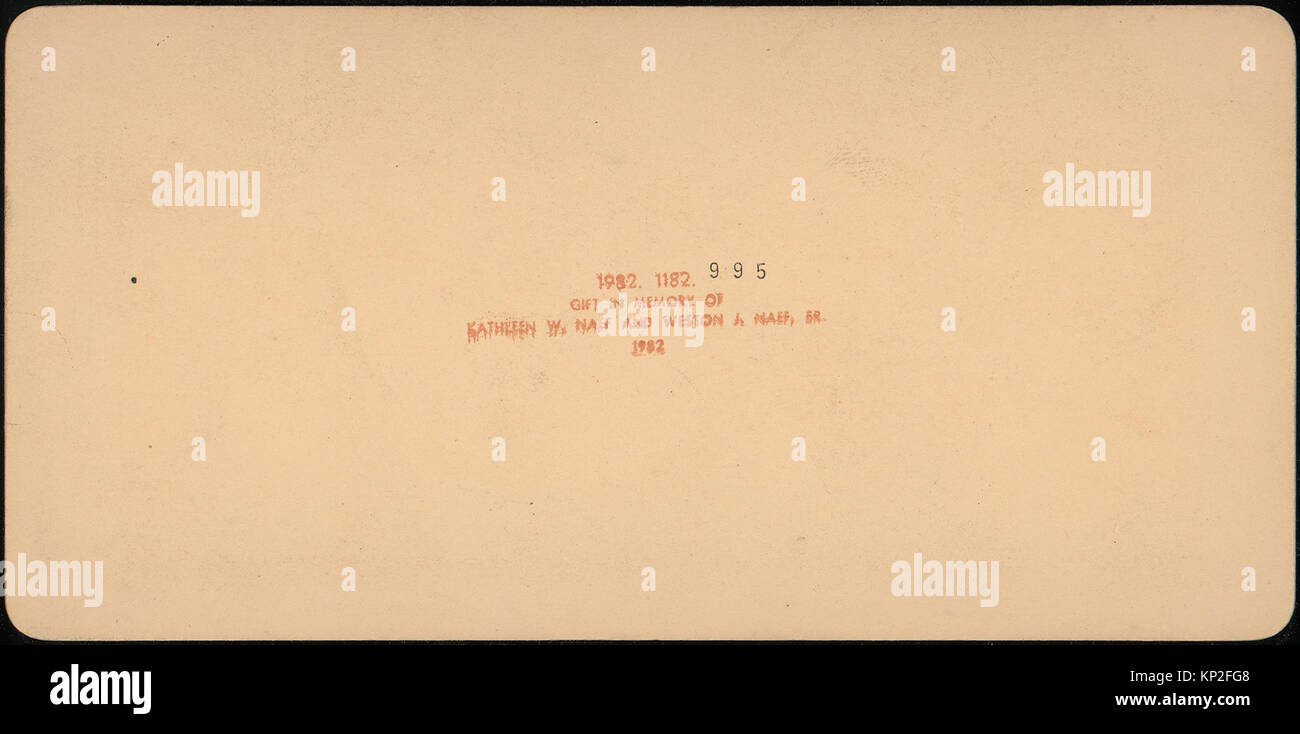 Cet ensemble de quatre images stéréographiques représente des nourrissons, montrant des caractéristiques physiques et des expressions tout en illustrant la documentation photographique précoce de l'enfance. Banque D'Images