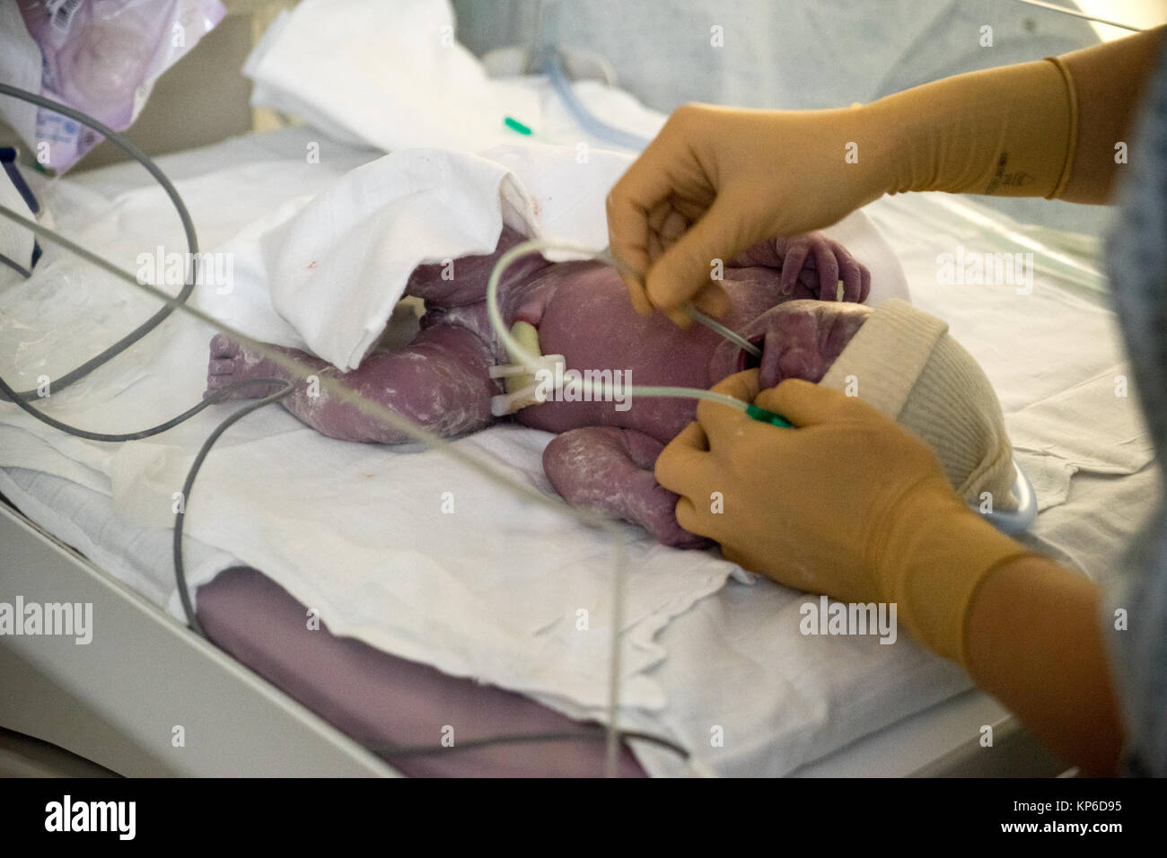 La naissance par césarienne Banque D'Images