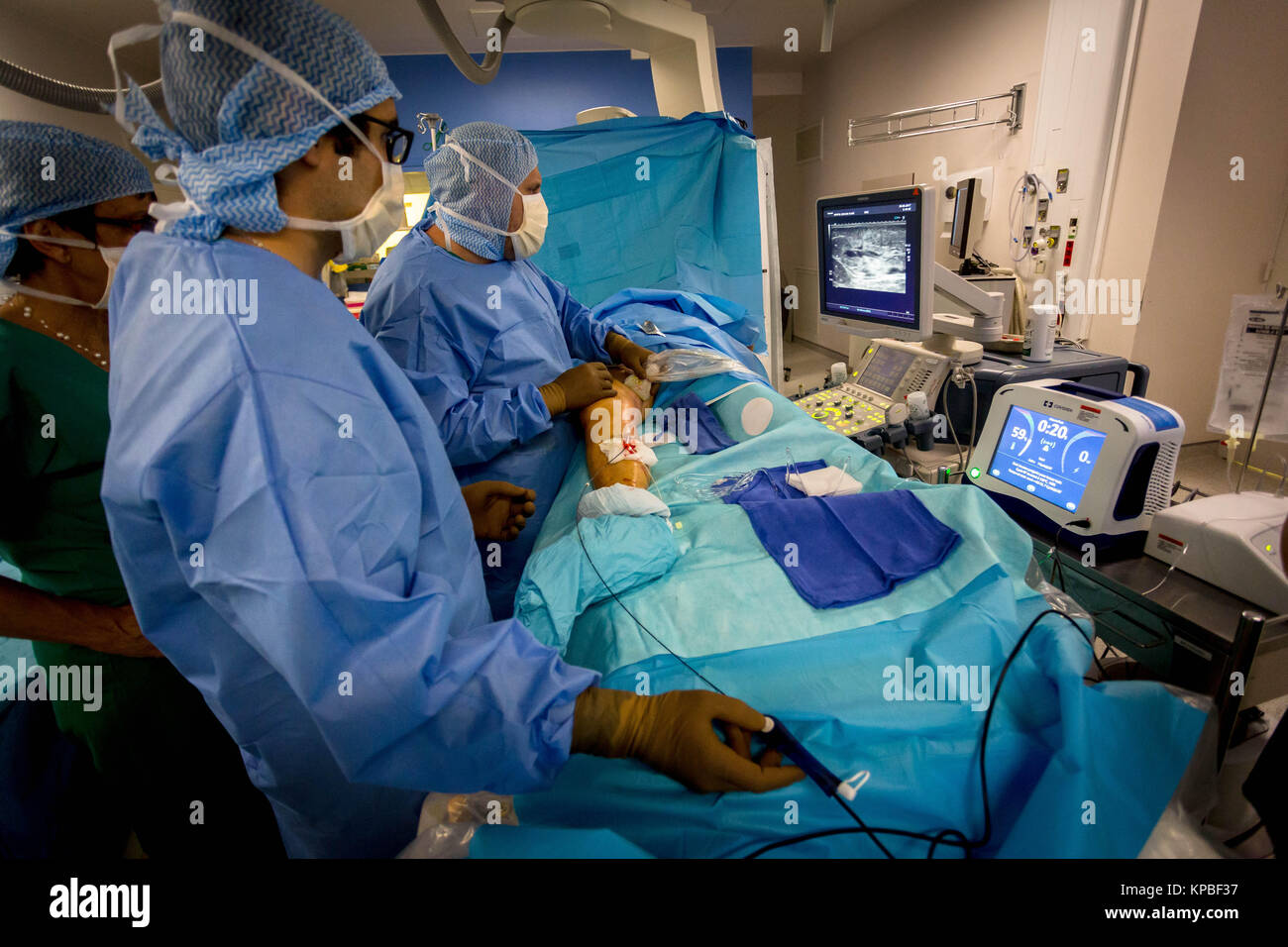 Traitement des varices par radiofréquence, l'hôpital de Dijon, France. Banque D'Images