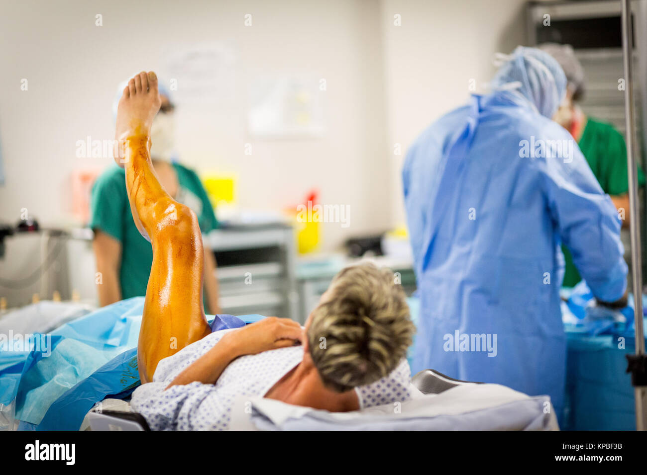 Traitement des varices par radiofréquence, l'hôpital de Dijon, France. Banque D'Images