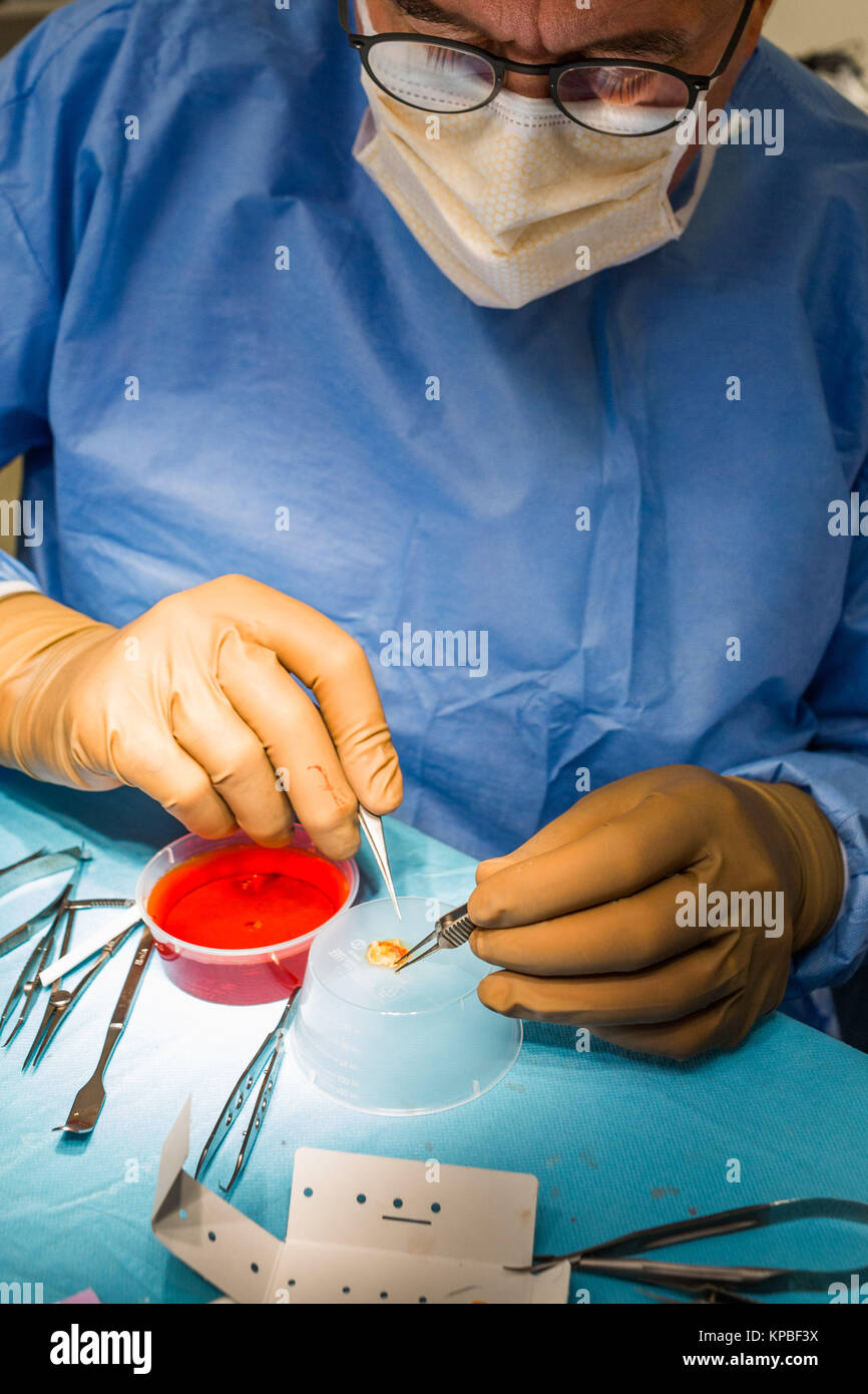 Sous anesthésie générale d'implantation d'une prothèse rétinienne Argus® II (Second Sight), service d'Ophtalmologie de l'Hôpital de Bordeaux, France. Banque D'Images