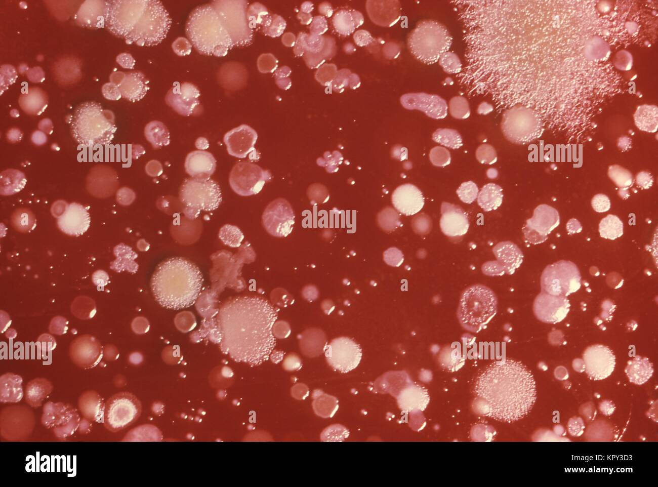 Close up de l'anthrax dans des cellules de petri, 1980. Image courtoisie CDC. () Banque D'Images