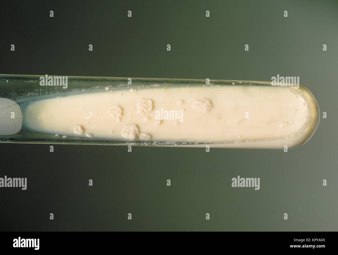 C'est un pente Lowenstein-Jensen culture du champignon Paracoccidioides brasiliensis cultivées à 37 C. C'est le seul agent étiologique de la maladie d'Paracoccidioidomycosis, 1969. Paracoccidioides brasiliensis est géographiquement limitée aux domaines de l'Amérique du Sud et centrale. Image courtoisie CDC/Dr. William Kaplan. Banque D'Images