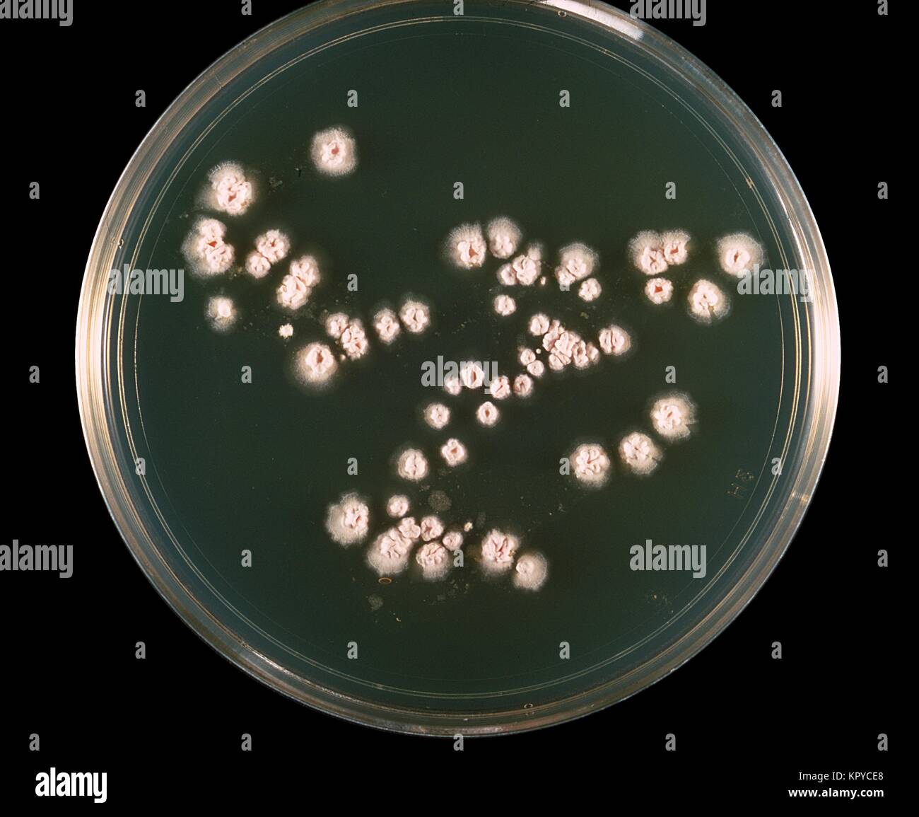 Il s'agit d'une culture de la plaque de la bactérie Nocardia asteroides cultivées sur milieu gélosé 7H10{} à 37 degrés C. Le complexe Nocardia astéroïdes bactérienne est une grave menace pour les sujets immunodéprimés, en particulier ceux avec les greffes, la maladie pulmonaire, et le SIDA, 1969. N. astéroïdes provoque au moins 50  % des infections invasives de Nocardiosis. Image courtoisie CDC/Dr. William Kaplan. Banque D'Images