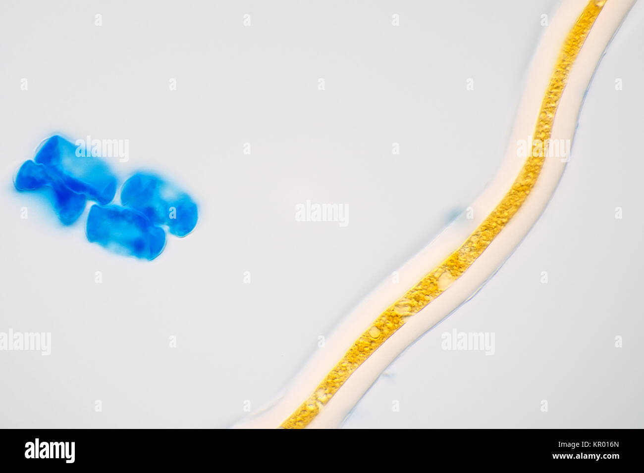 Les particules de lumière Microphotographie d'un échantillon d'air : fougère les sporanges pièces et certains végétaux, sur la photo est d'environ 170 micromètres de large Banque D'Images