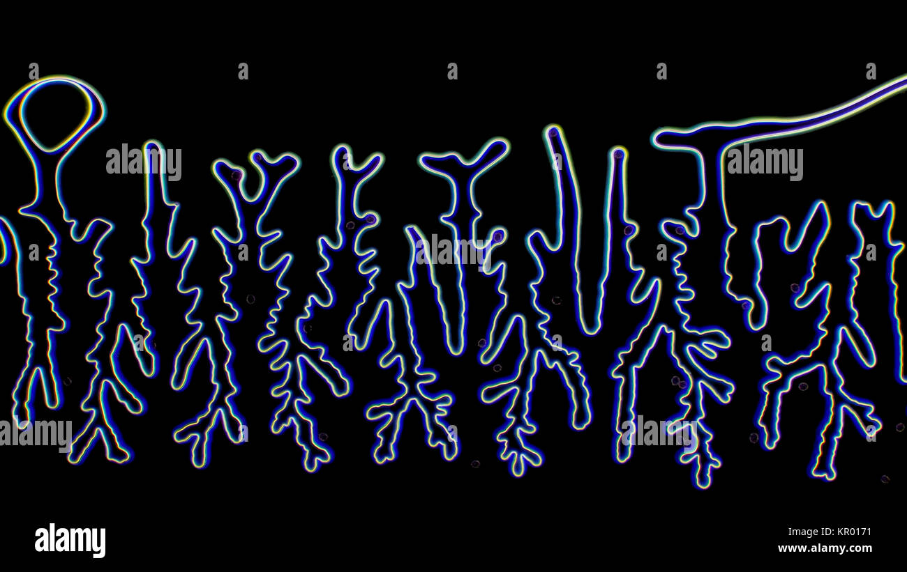 Micrographie champ sombre d'une tache sur une pointe de microscope, préparé sur la photo est d'environ 0,8 mm de large Banque D'Images