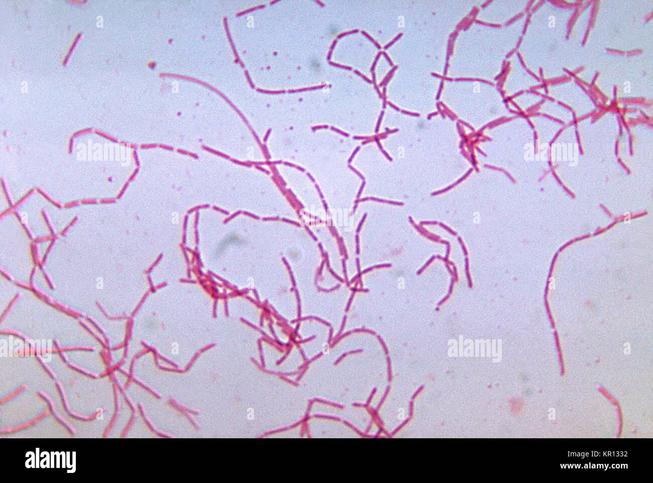 Cette microphotographie montre Bacteroides trichoides après avoir été cultivées dans un milieu thioglycolate pendant 48 heures, 1972. Bacteroides spp. occupent une proportion importante de la population normale de la flore bactérienne de l'homme, principalement dans la région intestinale. Ils n'ont pas d'endotoxine dans leur membrane cellulaire, afin que l'infection se produit après un traumatisme grave à la région abdominale. Image courtoisie CDC/Dr. C. R. Dowell, Jr. Banque D'Images