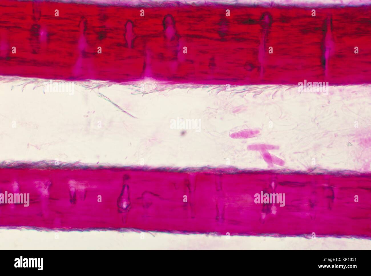 Cette microphotographie montre des indications du champignon Trichophyton mariatii lors d'une perforation de cheveux test, 1973. Le genre Trichophyton habite le sol, les humains ou les animaux, et est l'une des principales causes de la peau, cheveux et ongles, c.-à-d., dermatophytose chez les humains. Image courtoisie CDC/Dr. Arvind A. Padhye. Banque D'Images