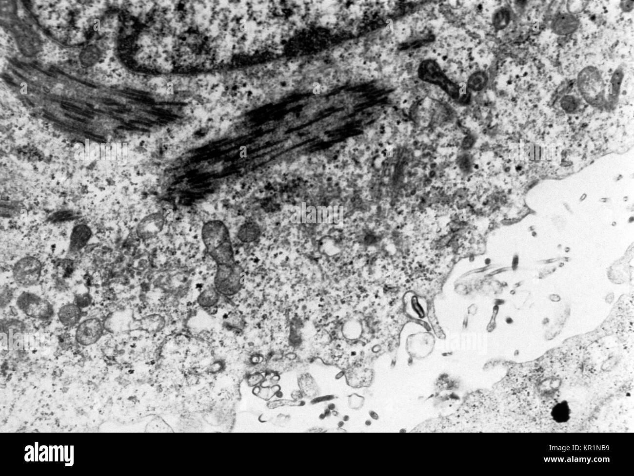 Ce micrographe montre une section fine contenant le virus Ebola, l'agent causal de la fièvre hémorragique Africaine, 1977. Le virus Ebola est un membre de la famille Filovirus. Il est connu pour se propager par contact étroit avec un hôte infecté. Les taux de mortalité d'une personne atteinte d'une fièvre hémorragique varient de 50 à 90  %. Image courtoisie CDC/Dr. Fred Murphy. Banque D'Images