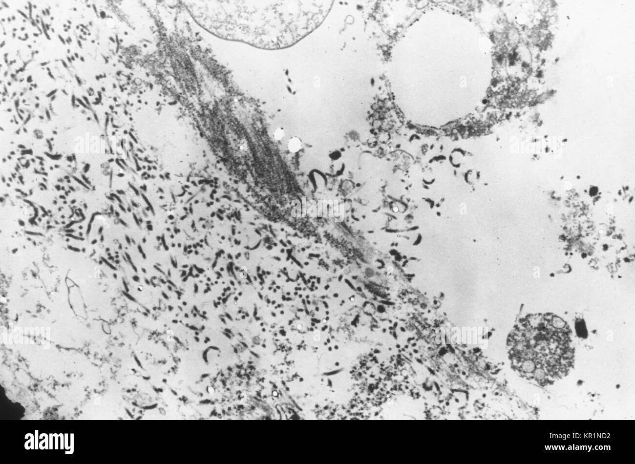 Electronmicrograph montre une section fine contenant le virus Ebola, l'agent causal de la fièvre hémorragique Africaine, 1976. La période d'incubation du virus Ebola varie de 2 à 21 jours avec l'apparition soudaine de la maladie, caractérisée par de la fièvre, maux de tête, des douleurs musculaires et des maux de gorge, faiblesse, et, suivi de la diarrhée, des vomissements et des douleurs à l'estomac. Image courtoisie CDC/Dr. Fred Murphy. Banque D'Images