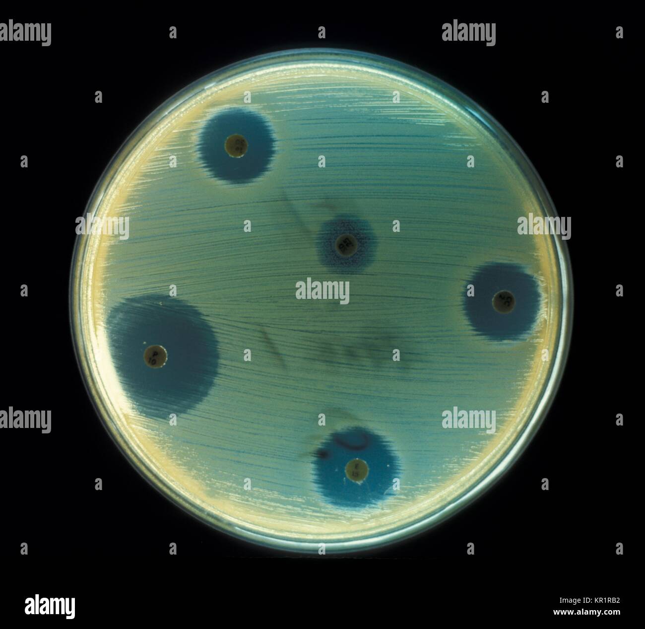 Les bactéries aérobies, Staphylococcus aureus, cultivés sur une plaque de gélose de sensibilité aux médicaments pour l'essai dans un environnement anaérobie, 1972. La toxine produite par Staphylococcus aureus provoque la maladie "taphylococcal' intoxication . Les symptômes de cette intoxication sont les nausées, vomissements et diarrhée. Image courtoisie CDC/Don Stalons. Banque D'Images