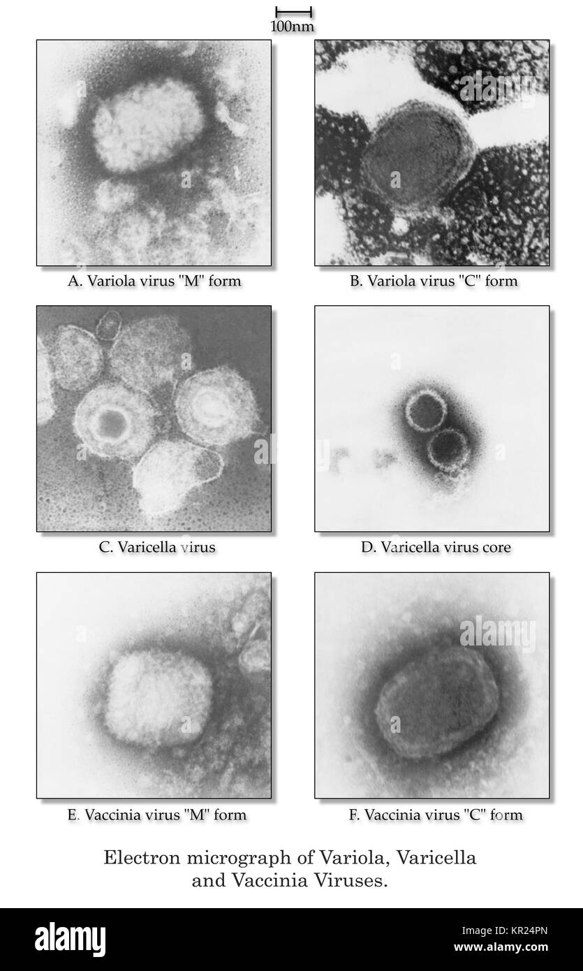 Les micrographies électroniques de virus variolique, la varicelle et la Vaccine virions. Les micrographies électroniques de haut en bas : virion variolique (formulaires M et C), la varicelle et virion core virion, virion de la vaccine (formulaires M et C), 1975. Image courtoisie CDC/Dr. James Nakano. Banque D'Images