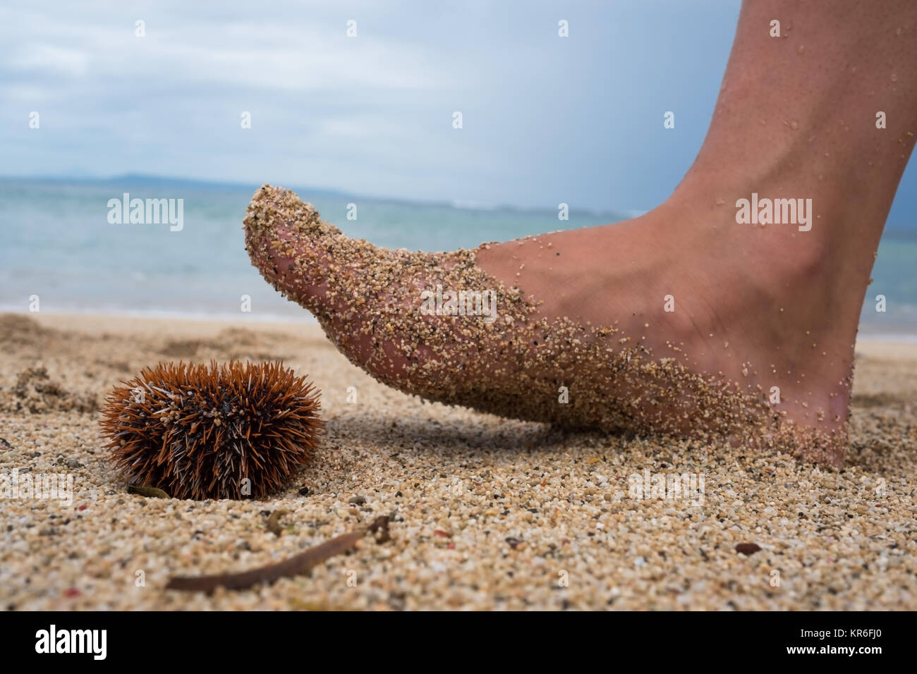 Un homme marche le long de la plage et est sur le point d'étape sur un oursin venimeux. Danger en vacances dans un pays tropical. Banque D'Images
