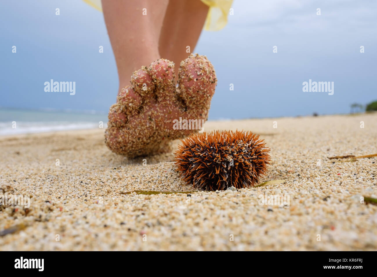 Un homme marche le long de la plage et est sur le point d'étape sur un oursin venimeux. Danger en vacances dans un pays tropical. Banque D'Images