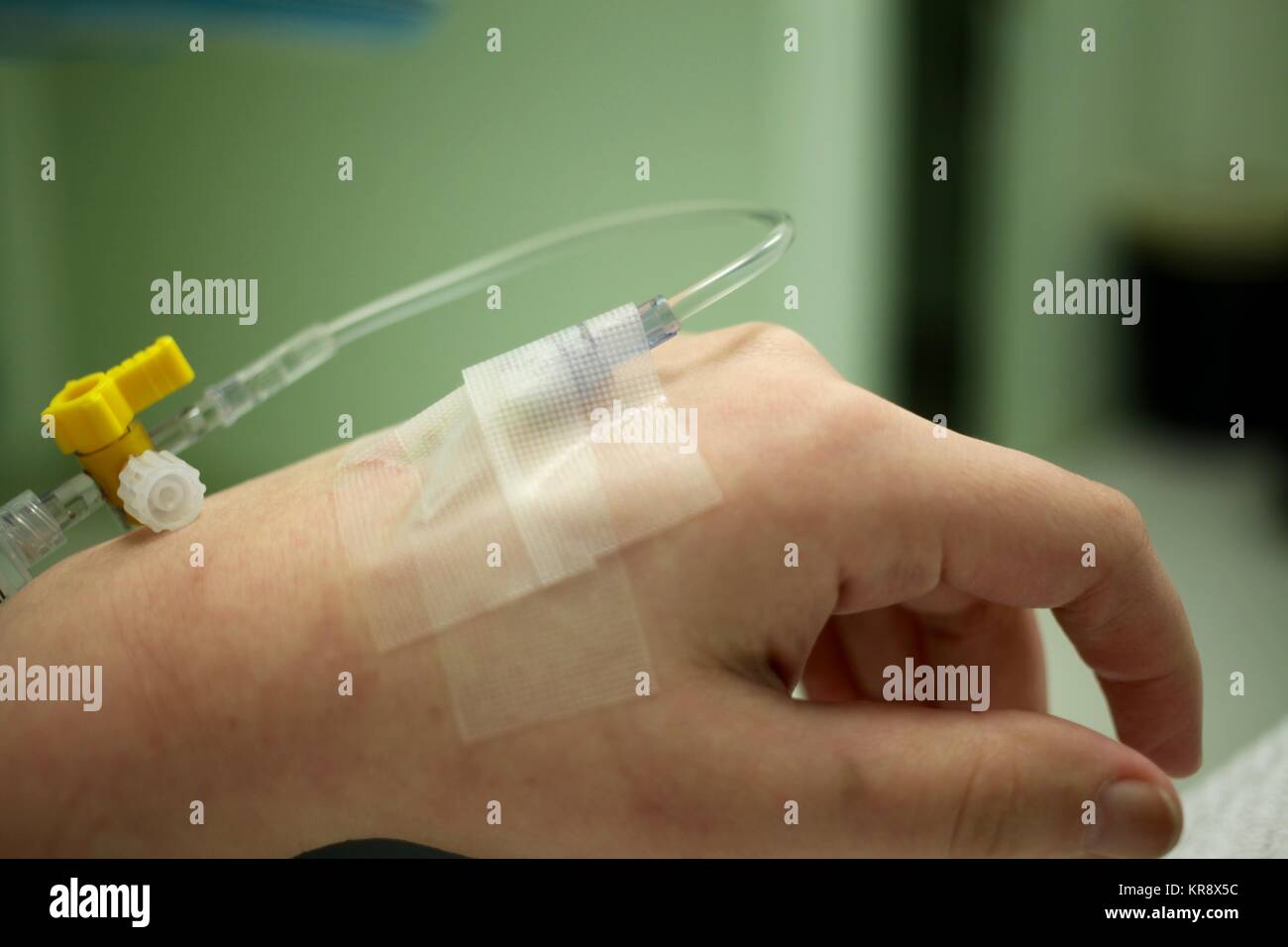 Close up d'un IV aiguille dans une main les patients Banque D'Images