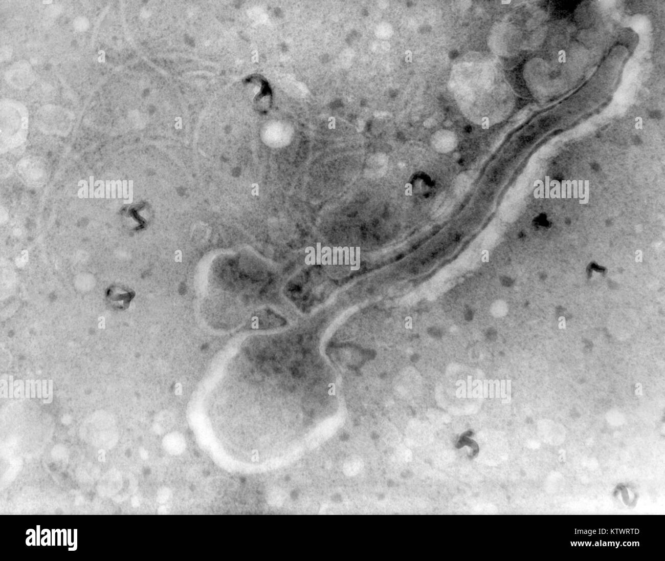 Une Microphotographie d'une bactérie Treponema pallidum. Une photomicrographie de T. pallidum une virulente bactérie, rompue à 6 000 psi, 1970. Treponema pallidum est l'agent responsable de la syphilis. Il contient l'un des plus petits génomes procaryotes comprenant environ 1000 paires de kilobases. Image courtoisie CDC, VDRL Dept. Banque D'Images