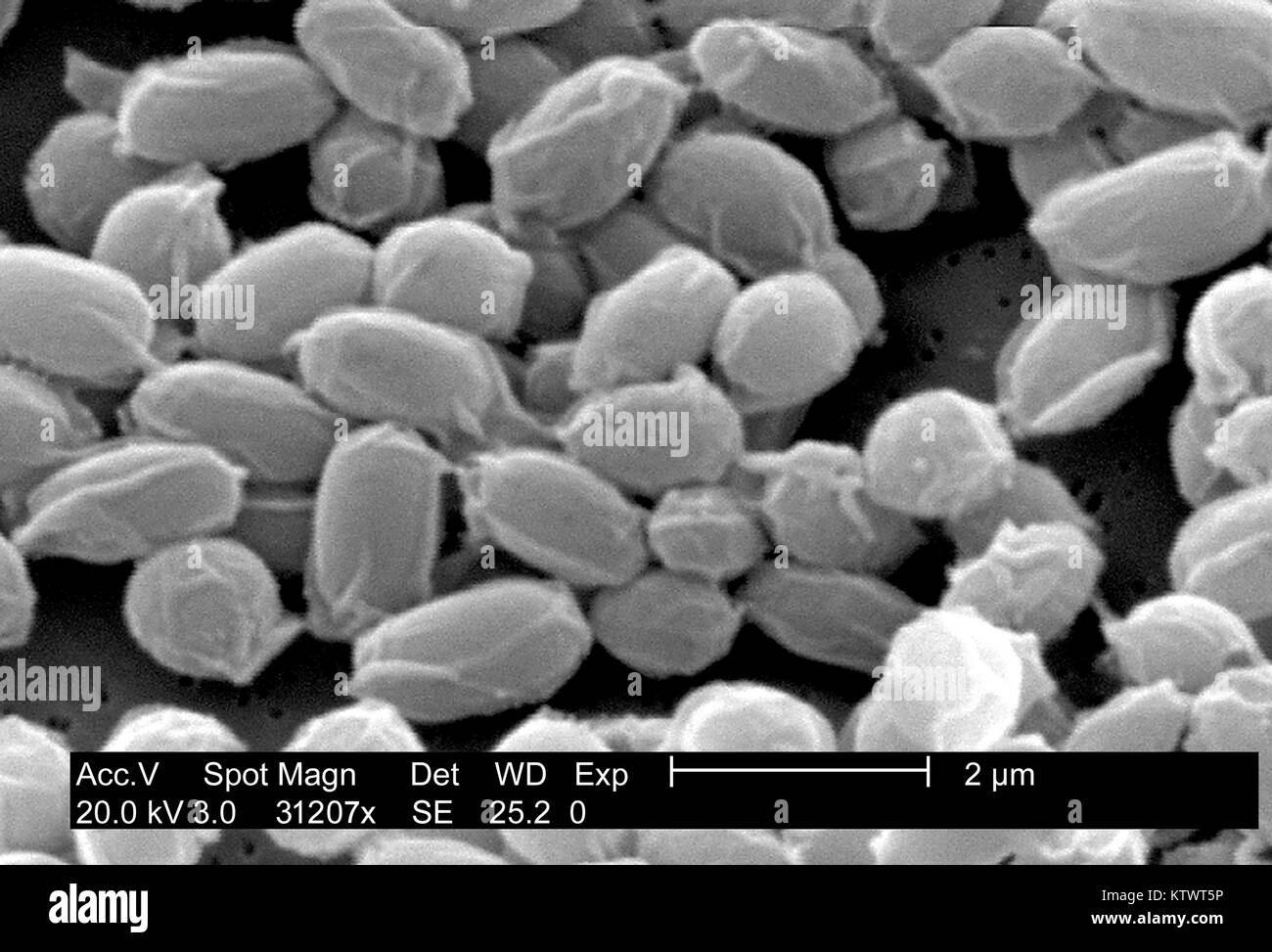 Sous un très haut niveau d'agrandissement de 31, 207X, cette l'analyse des électrons Microphotographie (SEM) dépeint les spores de la souche Sterne de bactéries Bacillus anthracis. Pour une version colorisée de cette image voir PHIL 10023. L'une des principales caractéristiques de la souche Sterne de B. anthracis est la surface ridée de la protéine coat de ces spores bactériennes. Ces spores peuvent vivre pendant de nombreuses années, qui permet à la bactérie de survivre dans un état dormant. Image courtoisie CDC/Laura Rose, 2002. Banque D'Images