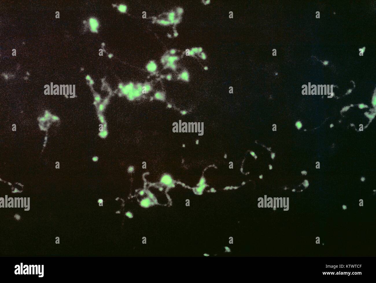 Une photomicrographie d'un anticorps fluorescent (FA) Tache de la bactérie Leptospira dans une impression de foie frottis. Ce spécimen a été d'un patient décédé de la Leptospirose, une maladie avec des symptômes incluant une forte fièvre, des maux de tête, frissons, douleurs musculaires, et des vomissements, et peut inclure une jaunisse (peau et yeux jaunes), yeux rouges, douleur abdominale, diarrhée, ou une éruption cutanée. Image courtoisie CDC/Mildred Galton, 1964. Banque D'Images