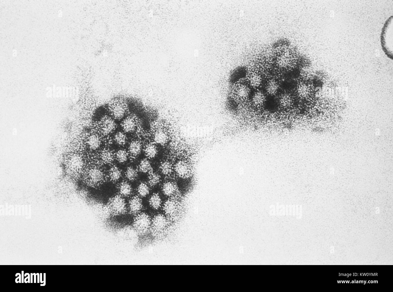 Un des électrons Microphotographie des norovirus, avec 27 - 32 nm moyennes particules virales. Les virus de Norwalk (et les calicivirus) sont des causes importantes de la gastro-entérite non bactérienne dans les États-Unis. Environ 181 000 cas de ce type d'intoxication alimentaire sont effectuées chaque année. Image courtoisie CDC/E. L. Palmer, 1981. Banque D'Images