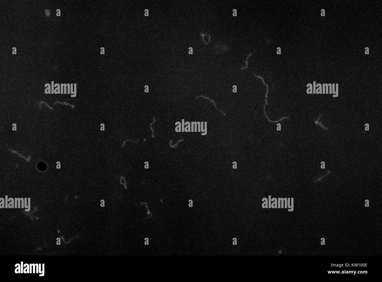 Treponema pallidum, la tache fluorescente pour anticorps tréponémiques (ALE) antigène. Une analyse de sang permet de détecter la présence d'anticorps produit par un patient infecté par la liaison de produits chimiques pour les anticorps qui deviennent fluorescents, ou glow green sous la lumière UV. Image courtoisie CDC, 1970. Banque D'Images